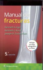 Manual De Fracturas